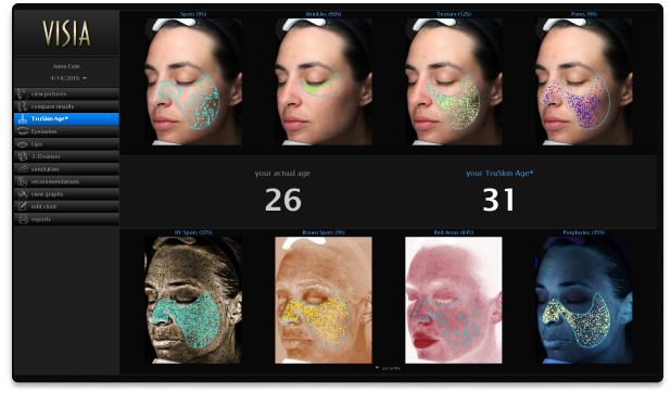 Comparaciones Significativas